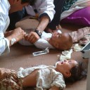 Cholera-In-Afghanistan
